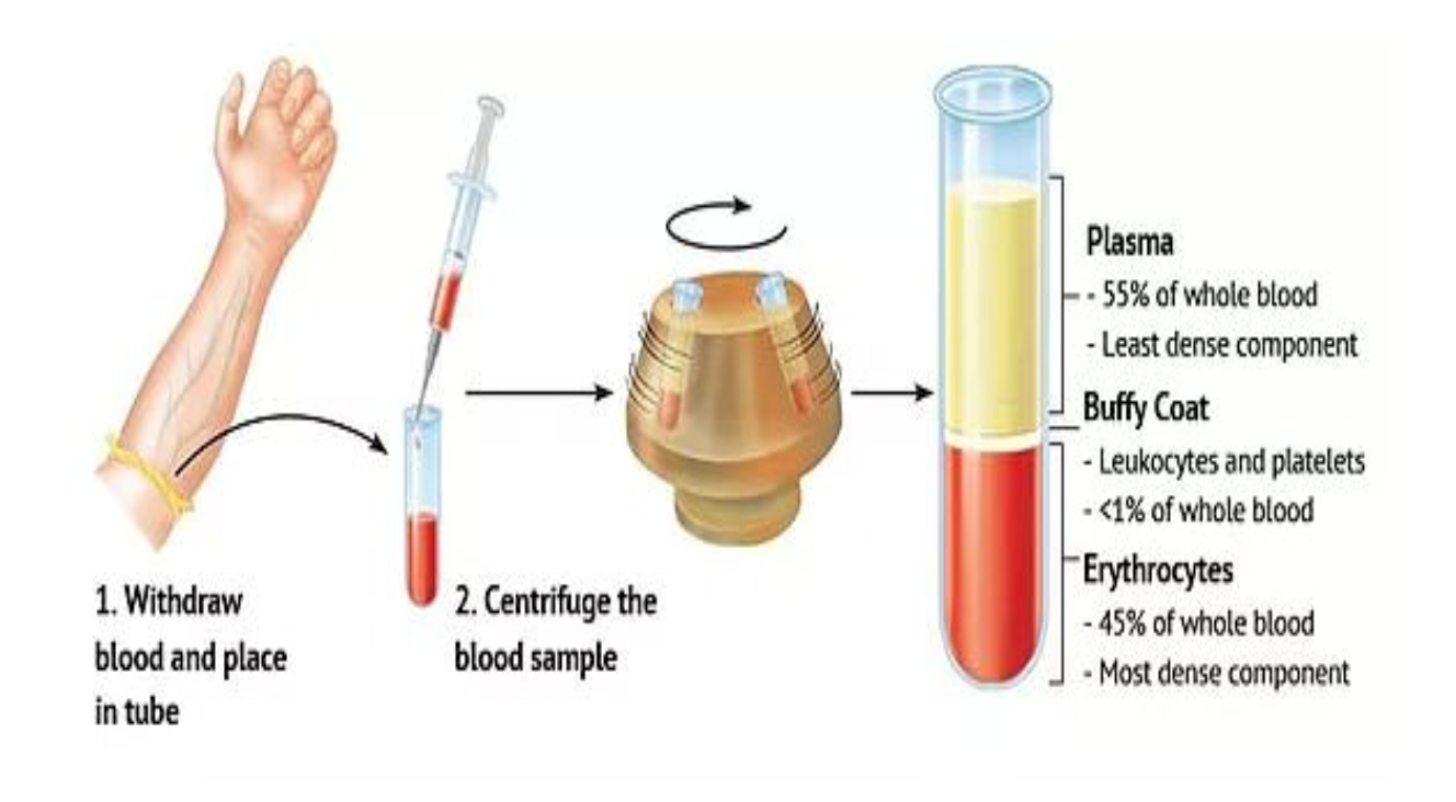 PRP for hair loss process