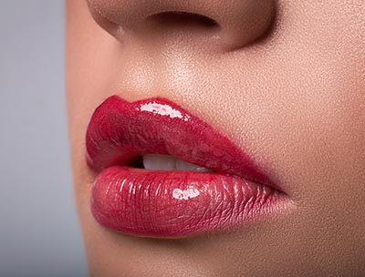 Lip Filler Treatment with Dermal Fillers