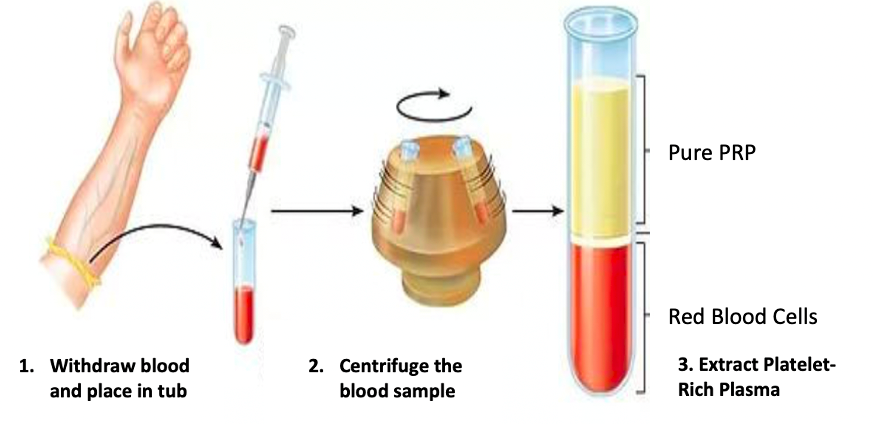 PRP for  process