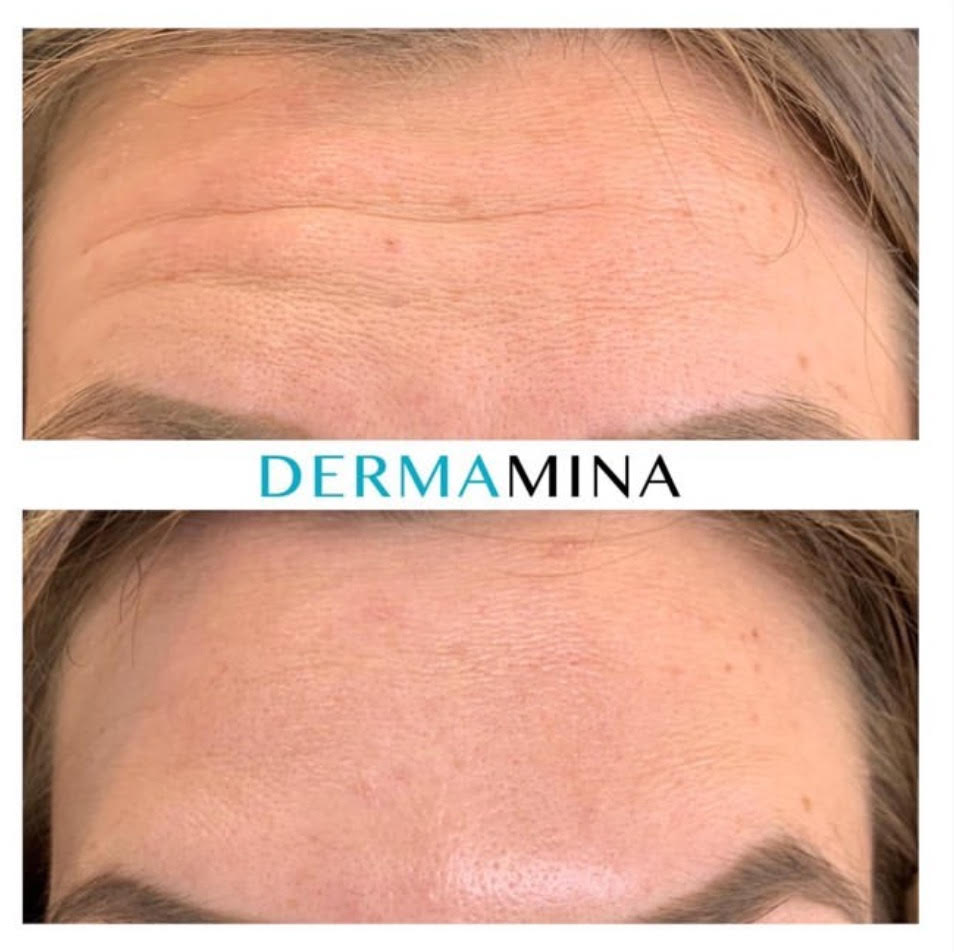 Before & After 1