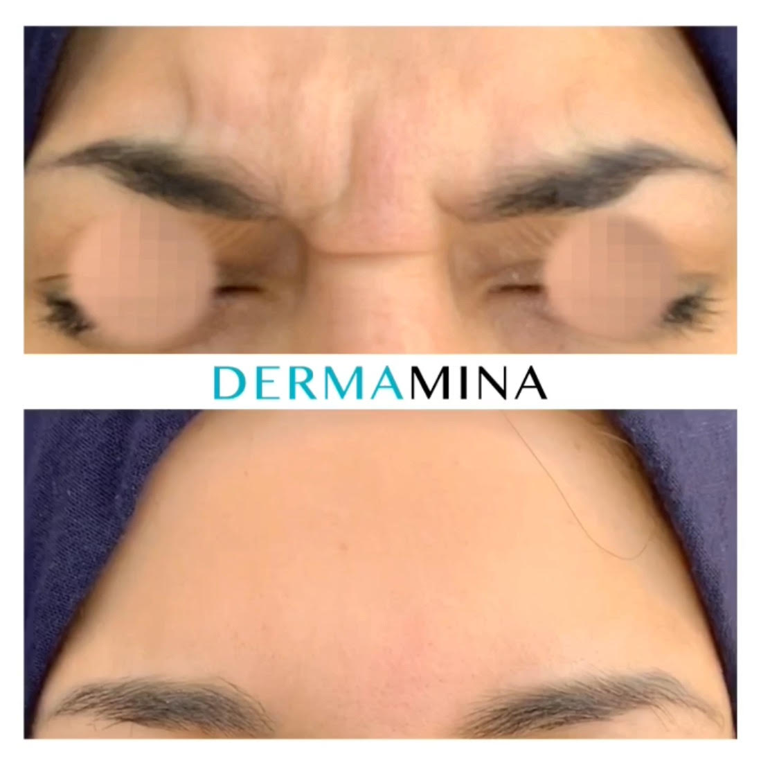 Before & After 2