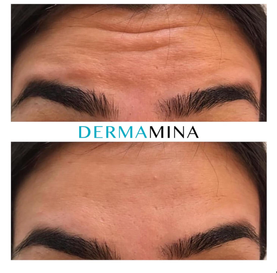 Before & After 3