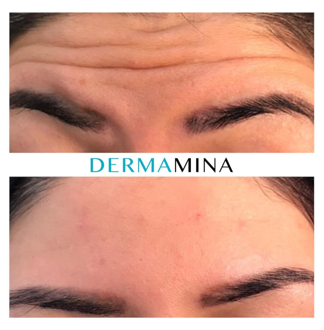 Before & After 4