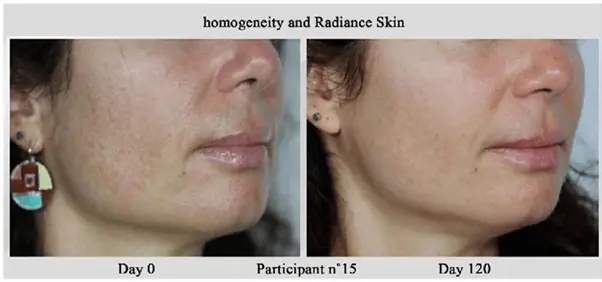 Before and after Nctf Biorevitaliser