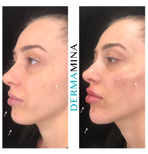 Before & After 1