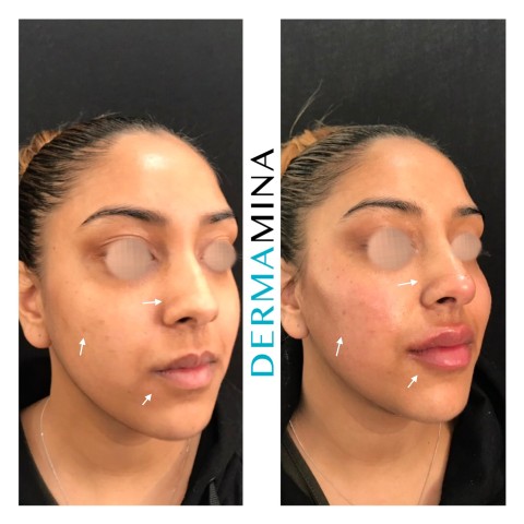 Before & After 3