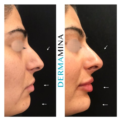 Before & After 5