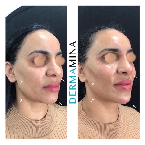 Before & After 7
