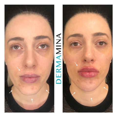 Before & After 8