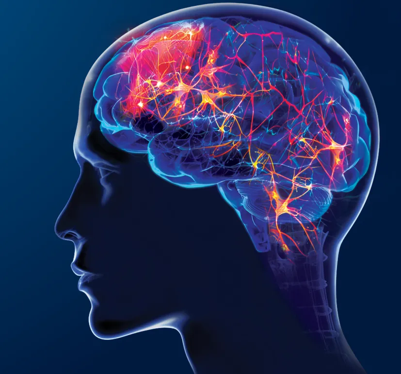 Brain Fog