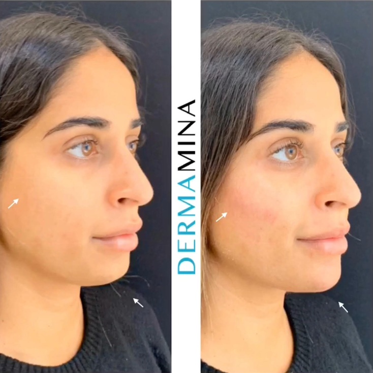 Before & After 2