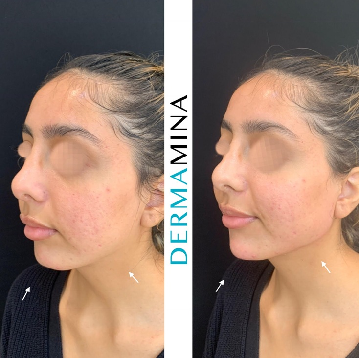 Before & After 4