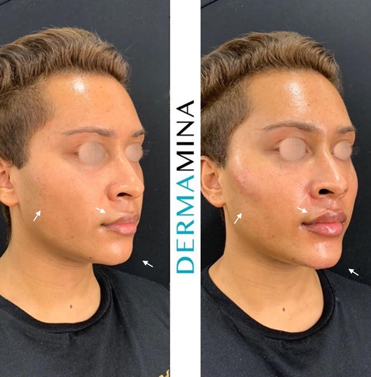 Before & After 8