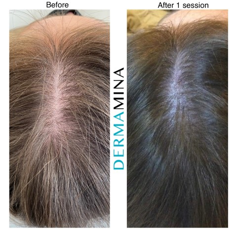 Before & After 3