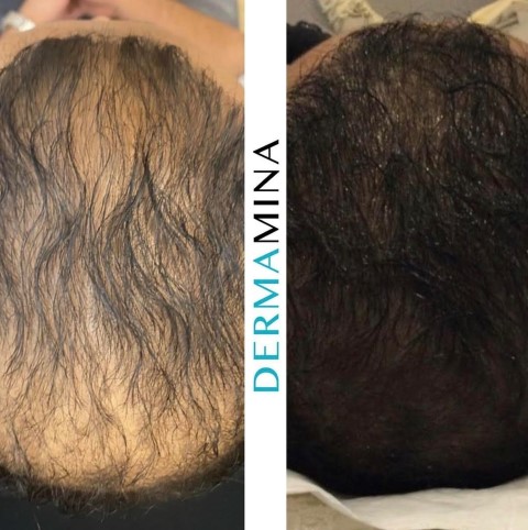 Before & After 16