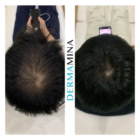 Before & After 9