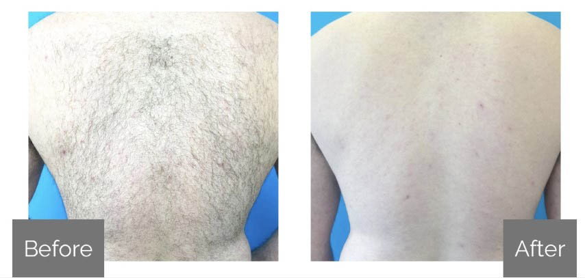 Before & After 1