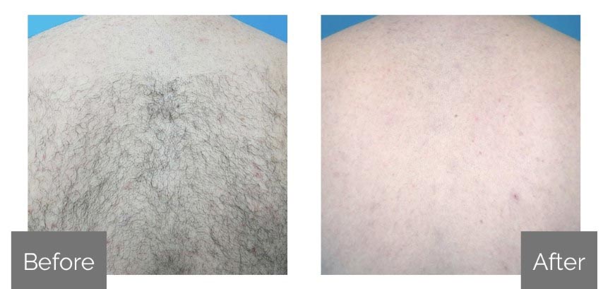 Before & After 2