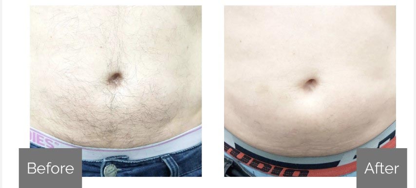 Before & After 3