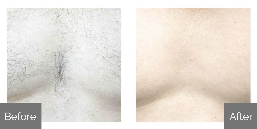 Before & After 5