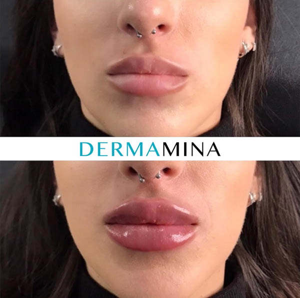 Before & After 1