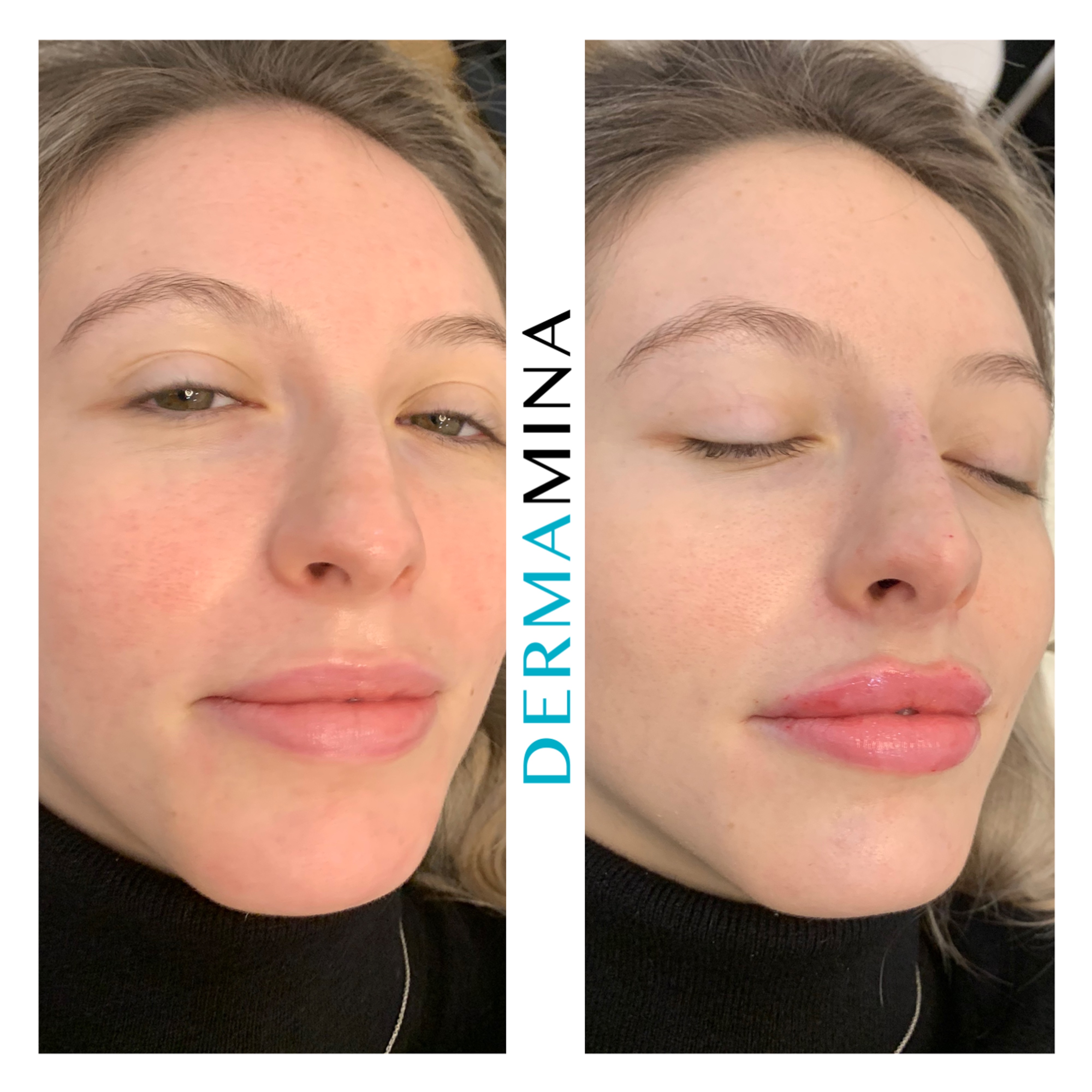 Before & After 18