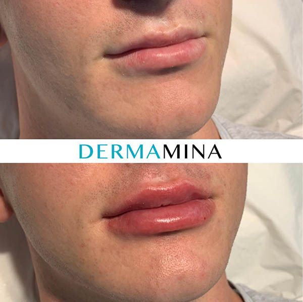Before & After 2