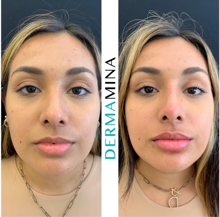 Before & After 21
