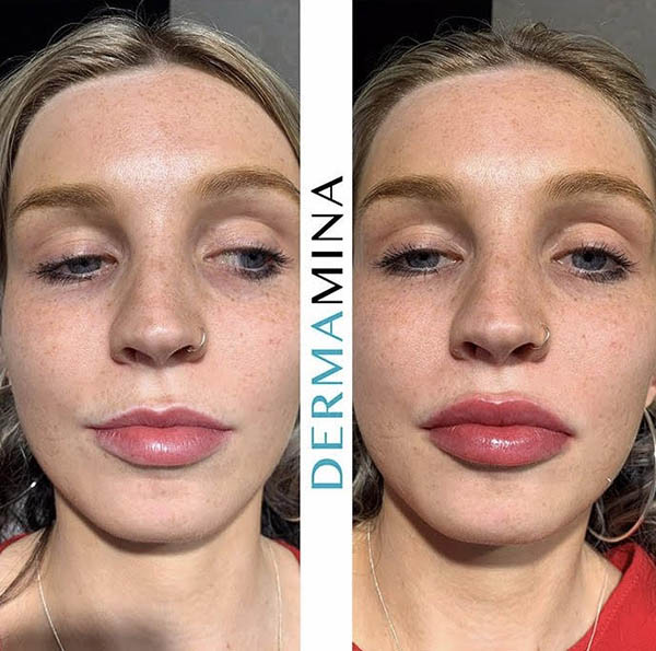 Before & After 5