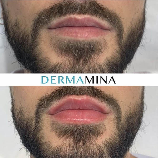 Before & After 6