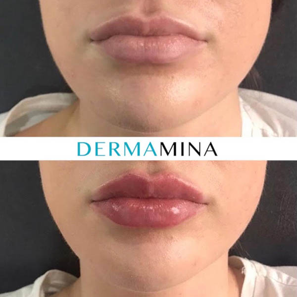 Before & After 9