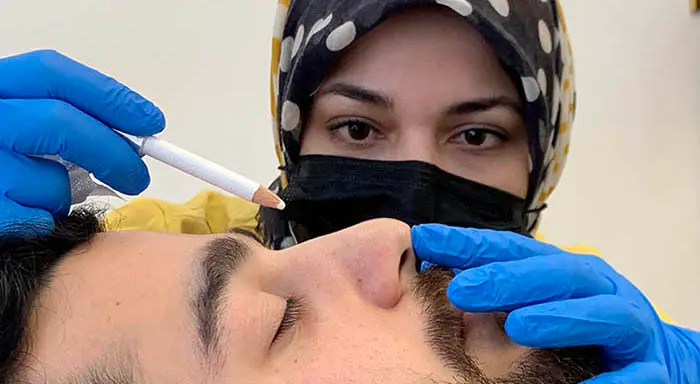 What is the "10-minute Nose Job"?