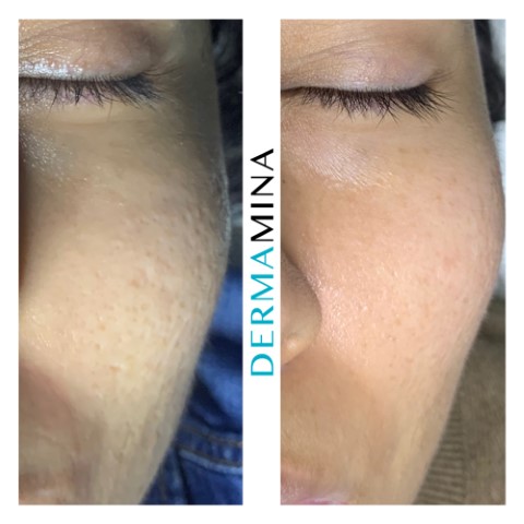 Before & After 8