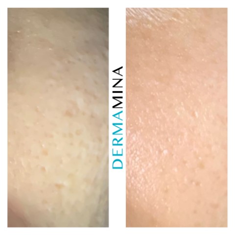 Before & After 9