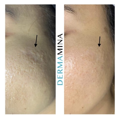 Before & After 10