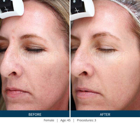 Before & After 1