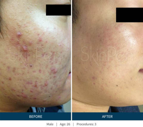 Before & After 2