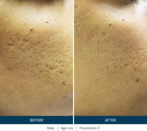 Before & After 3