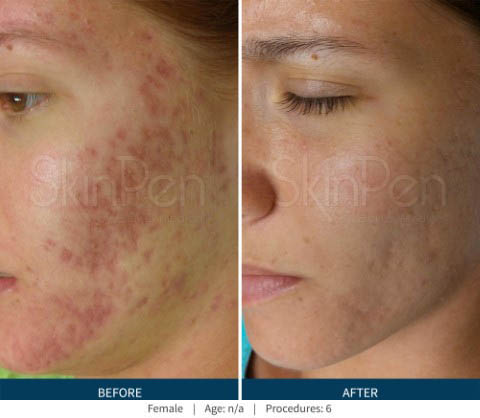 Before & After 5