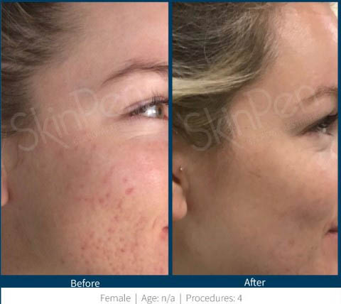 Before & After 6