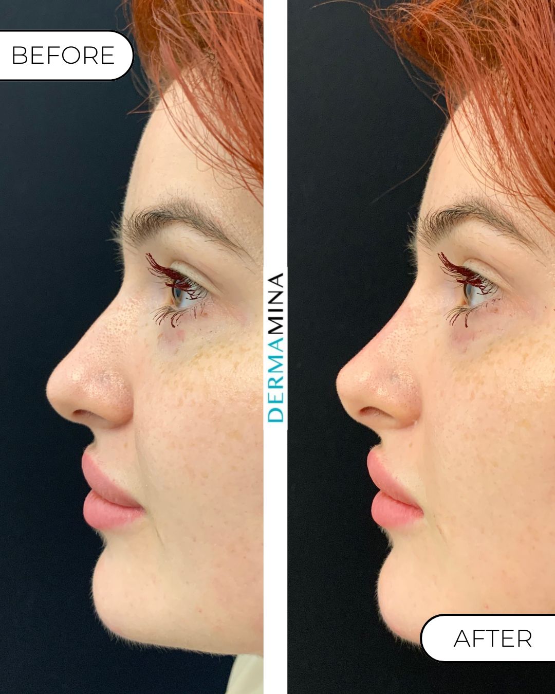 Before and After