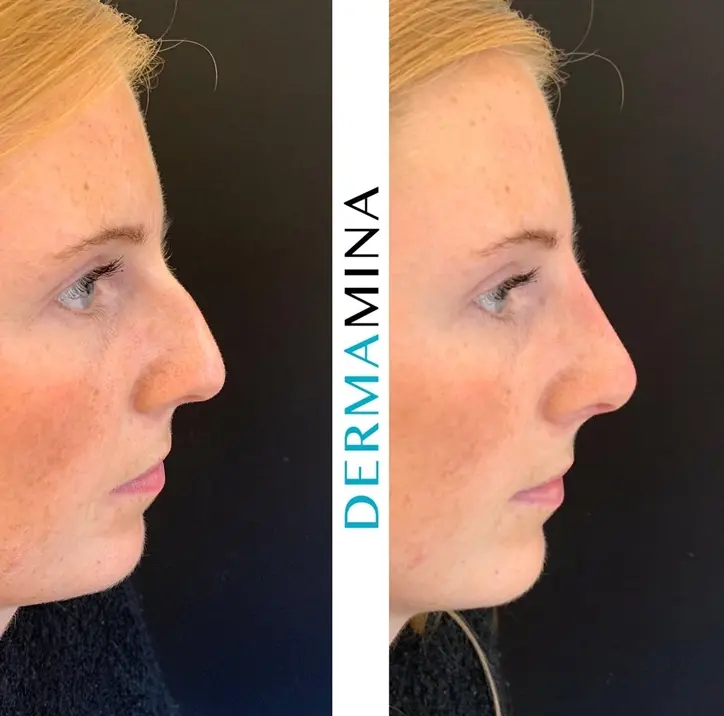 Before & After 10