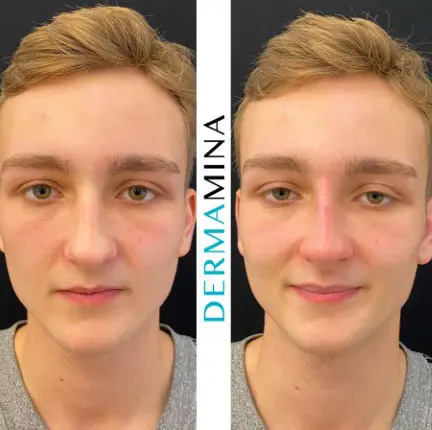Before & After 18