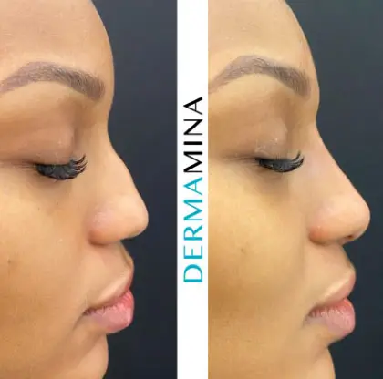 Before & After 19