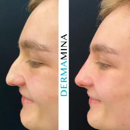 Before & After 21