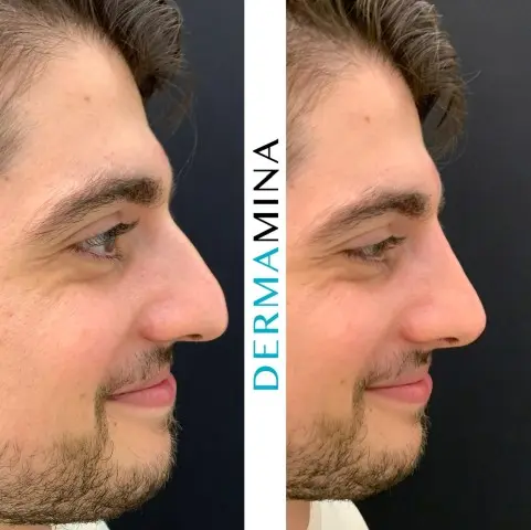 Before & After 3