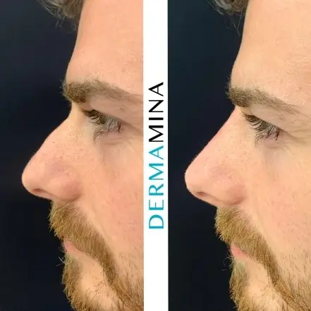 Before & After 4
