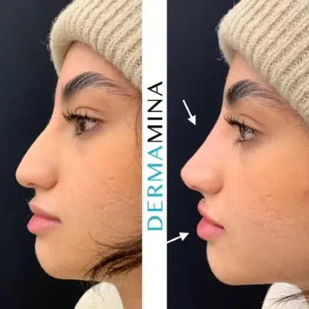 Before & After 6
