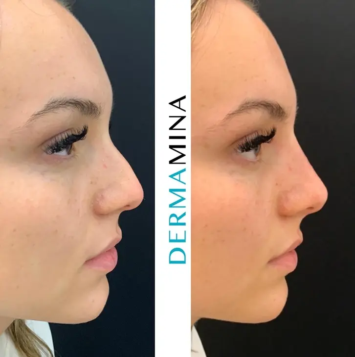 Before & After 8