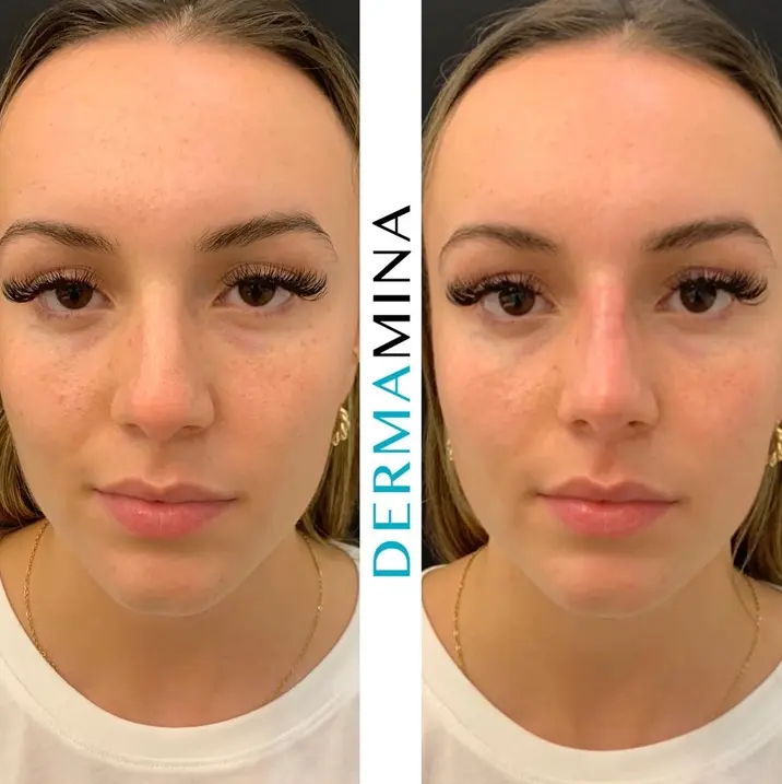Before & After 9